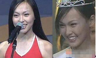 龅牙娱乐吃瓜,揭秘娱乐圈吃瓜背后的真相与笑料